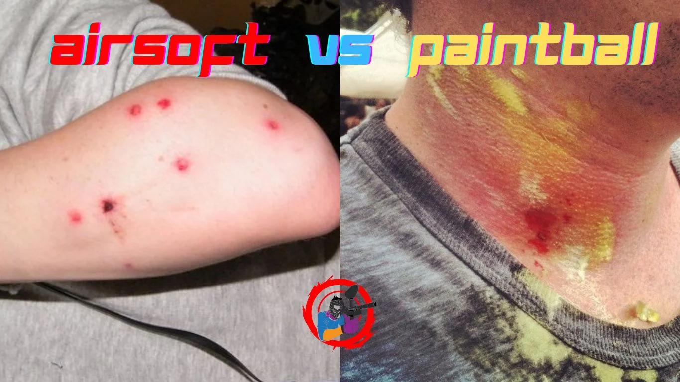 Injuries Resulting from Airsoft and Paintball